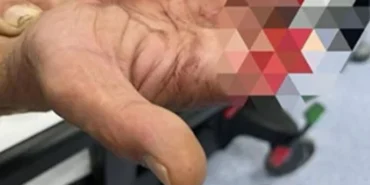 Isparta Organize Sanayi’de Korkutan Anlar: Halatın Kopmasıyla İşçi Tankerin Altında Kaldı