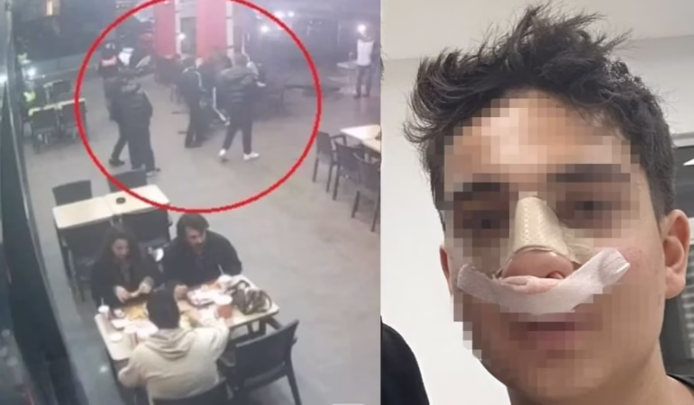 Antalya’da Akran Zorbalığı: Neden Bakıyorsun Diyerek Darbettiler
