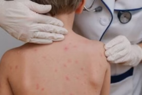 Isparta'da Kızamık Alarmı: Temaslılar Aşıya Çağrıldı