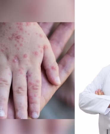 Isparta'da Kızamık Alarmı: Uzman Doktordan Kritik Aşı Uyarısı