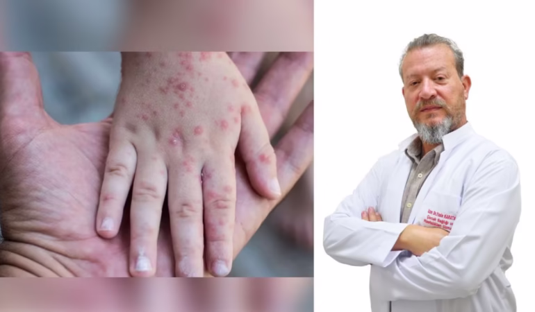 Isparta’da Kızamık Alarmı: Uzman Doktordan Kritik Aşı Uyarısı