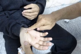 Isparta’da Otizmli Gencin Doğa Gezisi Sahipli Köpek Dehşetiyle Bitti