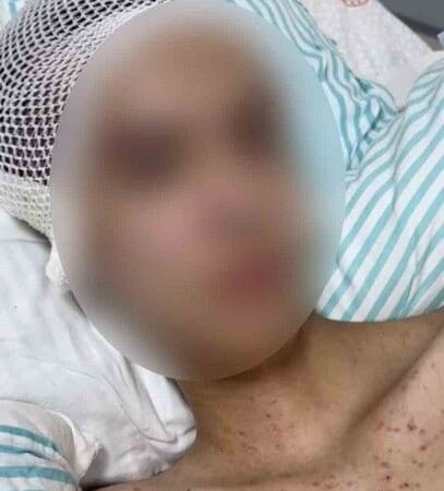 Burdur’daki Sır Perdesi Aralandı: Komadan Çıkan Mağdurun İfadesiyle Kan Donduran Gerçekler Ortaya Çıktı!